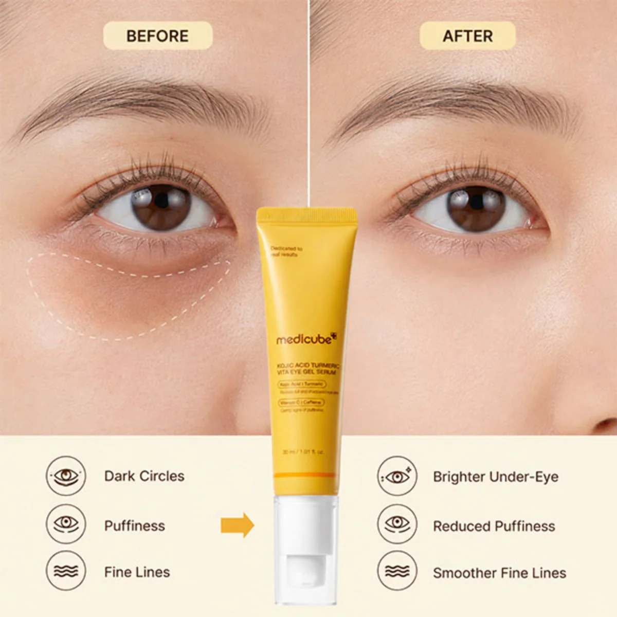 ژل‌سرم دور چشم مدیکیوب Medicube Kojic Acid Turmeric Vita حجم 30 میلی‌لیتر؛ نمای تکمیلی 3