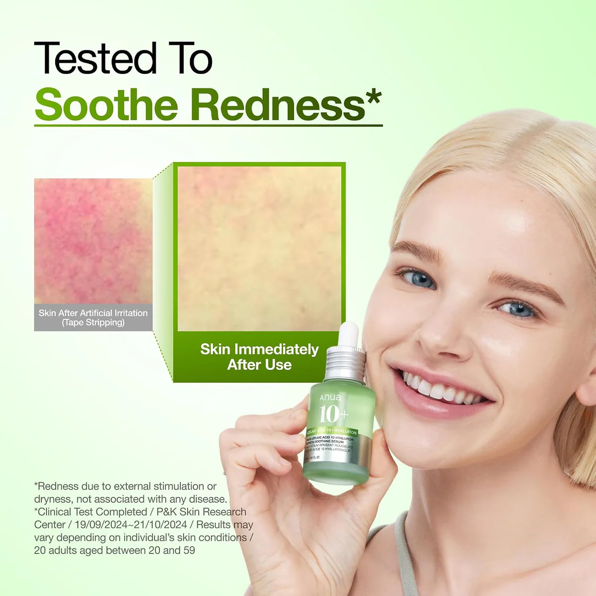 سرم آزالئیک اسید آنوا Anua Azelaic Acid 10 Hyaluron Redness Soothing Serum حجم 30 میلی‌لیتر؛ نمای تکمیلی 9