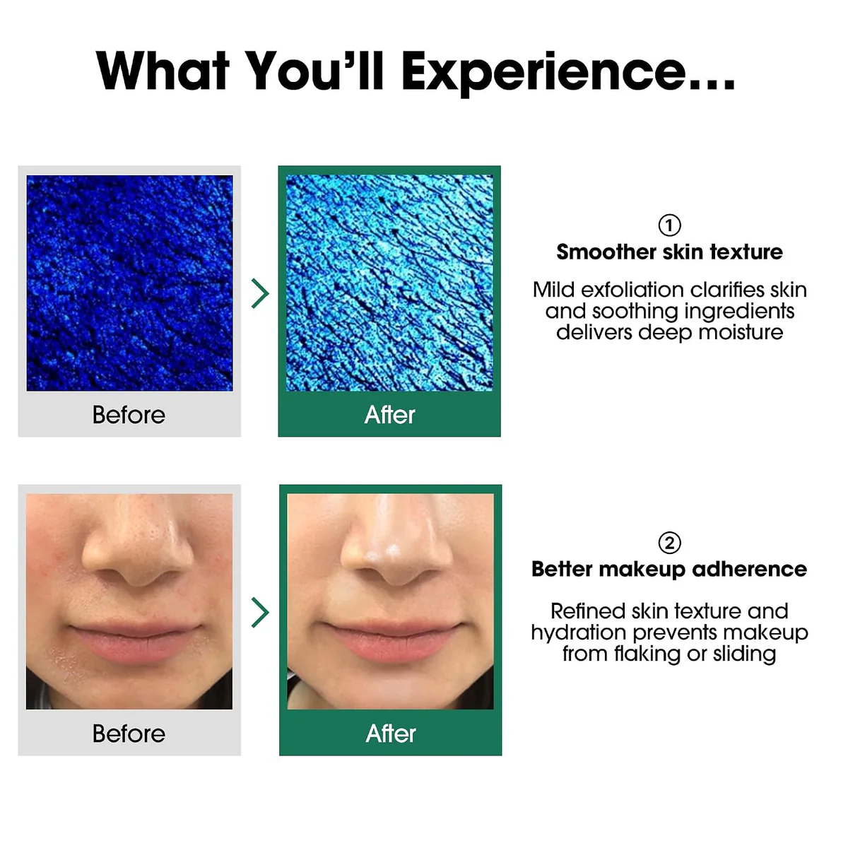تونر سام بای می SOME BY MI AHA-BHA-PHA 30 Days Miracle Toner حجم 150 میلی‌لیتر؛ نمای تکمیلی 2