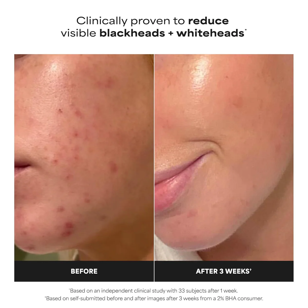 محلول لایه‌بردار پائولاز چویس Paula’s Choice Skin Perfecting 2% BHA حجم 118 میلی‌لیتر؛ نمای تکمیلی 5