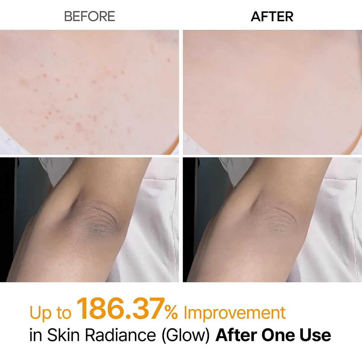 اسپری لایه‌بردار بدن دکتر ملاکسین Dr.Melaxin Peel Shot Kojic Acid & Turmeric حجم 200 میلی‌لیتر؛ نمای تکمیلی 3