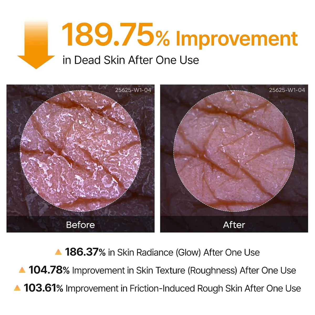 اسپری لایه‌بردار بدن دکتر ملاکسین Dr.Melaxin Peel Shot Kojic Acid & Turmeric حجم 200 میلی‌لیتر؛ نمای تکمیلی 8
