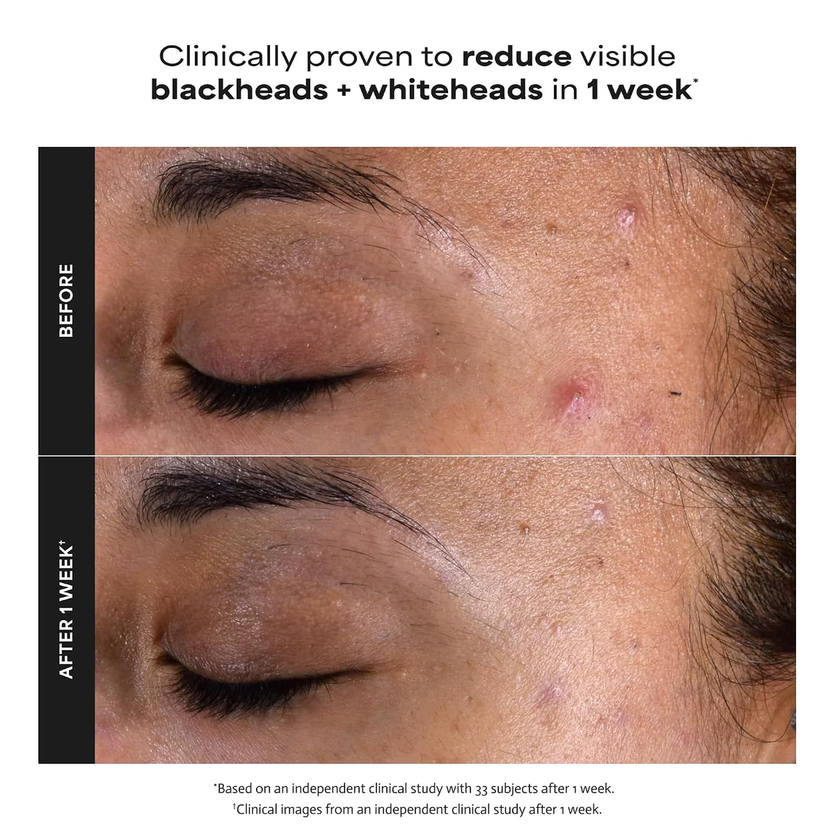 محلول لایه‌بردار پائولاز چویس Paula’s Choice Skin Perfecting 2% BHA حجم 118 میلی‌لیتر؛ نمای تکمیلی 9
